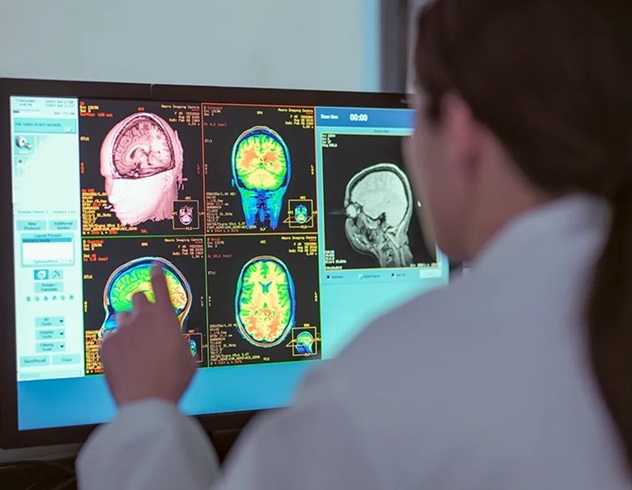 Imagen: RM-Linac permite a los médicos ver lo que sucede en el cerebro por primera vez (foto cortesía de Sylvester Comprehensive Cancer Center)